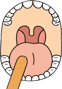 rêver de abaisse-langue interprétations: Si vous avez rêvé de abaisse-langue, voici la signification: