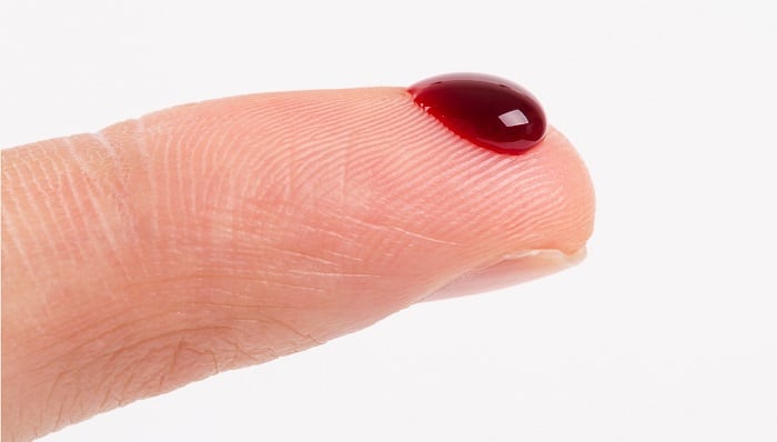 Rêver de saigner et son interprétation: Pourquoi rêver de saigner ?