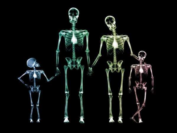 Rêver de radiographie et sa signification: Rêver de radiographie et sa signification: