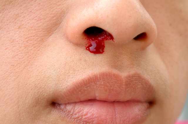 Le rêve de nez en sang et sa signification: Que signifie un rêve de nez en sang ?