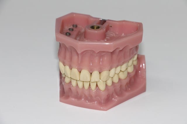 Un rêve de grincer des dents et sa signification: Que signifie rêver de grincer des dents ?