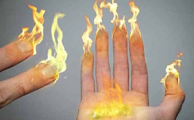 Un rêve de brûlure et sa signification: Que signifie rêver de brûlure ?
