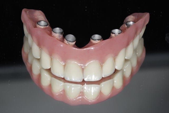 Un rêve de fausses dents et sa signification: Pourquoi rêver de fausses dents ?