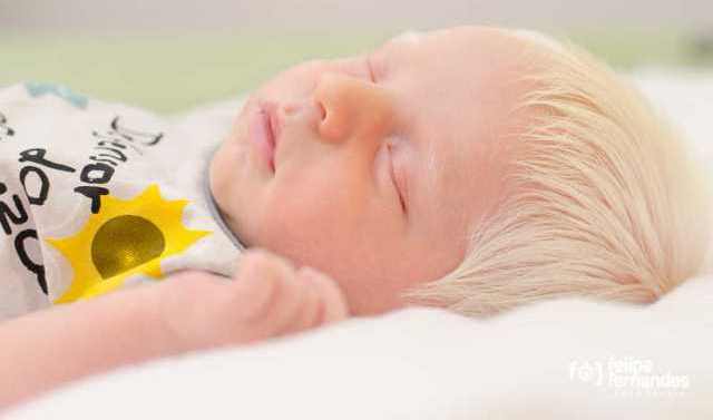 Un rêve d'albinos et sa signification: Que signifie rêver d'albinos ?