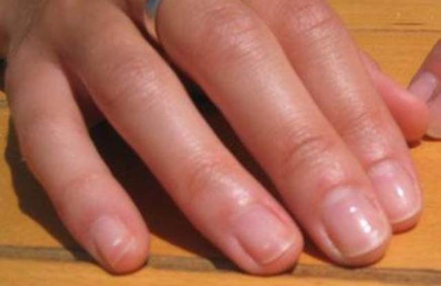 Un rêve de doigts et sa signification: Que signifie rêver de doigts ?