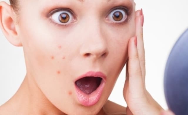 Que signifie rêver de boutons sur le visage ?