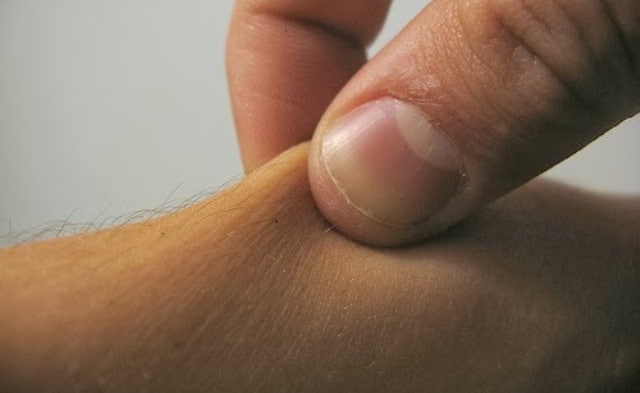 Un rêve de pincer et sa signification: Que signifie rêver de pincer ?