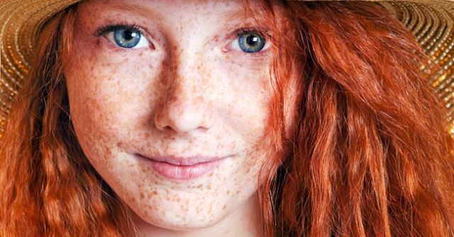 Un rêve de taches de rousseur et sa signification: Que signifie rêver de taches de rousseur ?