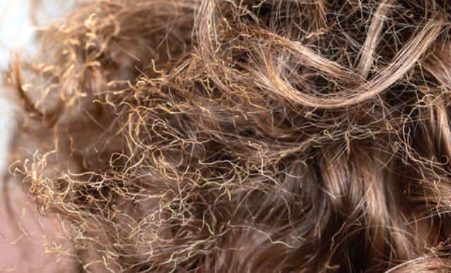 Un rêve de cheveux brûlés et sa signification: Que signifie rêver de cheveux brûlés ?